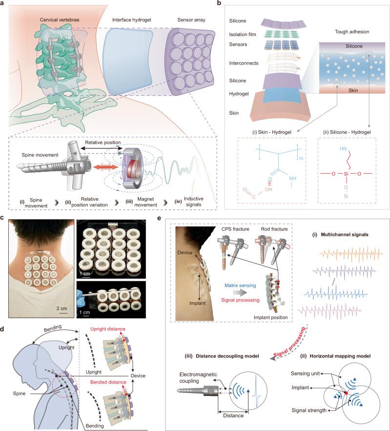 https://cdn.ncbi.nlm.nih.gov/pmc/blobs/4559/11379874/5fcb1548bff0/41467_2024_51987_Fig1_HTML.jpg
