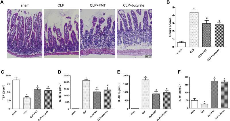 https://cdn.ncbi.nlm.nih.gov/pmc/blobs/455c/11841723/2020cbb31c00/shock-61-120-g008.jpg