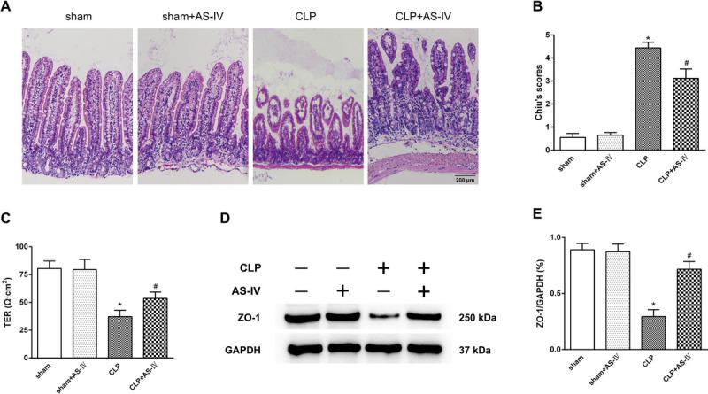 https://cdn.ncbi.nlm.nih.gov/pmc/blobs/455c/11841723/8756473f301e/shock-61-120-g003.jpg