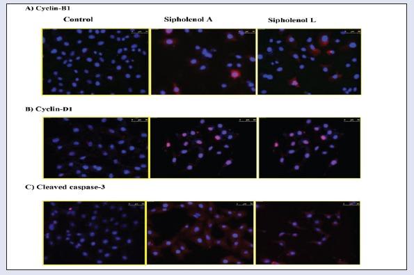 https://cdn.ncbi.nlm.nih.gov/pmc/blobs/455e/5407114/cae94c18686e/PM-13-37-g004.jpg