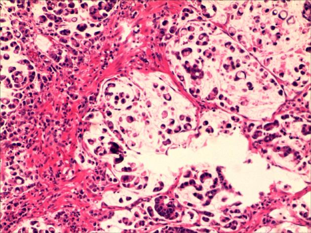 https://cdn.ncbi.nlm.nih.gov/pmc/blobs/456a/7559675/61072140f7b7/WJCC-8-4572-g003.jpg
