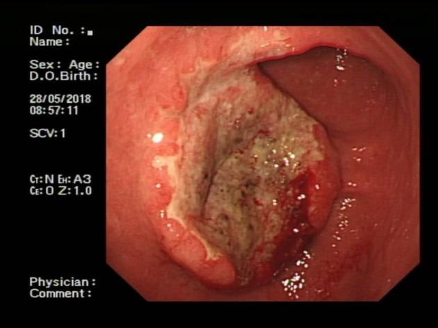 https://cdn.ncbi.nlm.nih.gov/pmc/blobs/456a/7559675/c5696ba33c96/WJCC-8-4572-g001.jpg