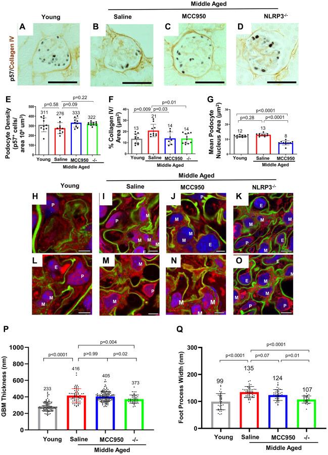 https://cdn.ncbi.nlm.nih.gov/pmc/blobs/456c/10415579/26fcf451a534/aging-15-204897-g003.jpg