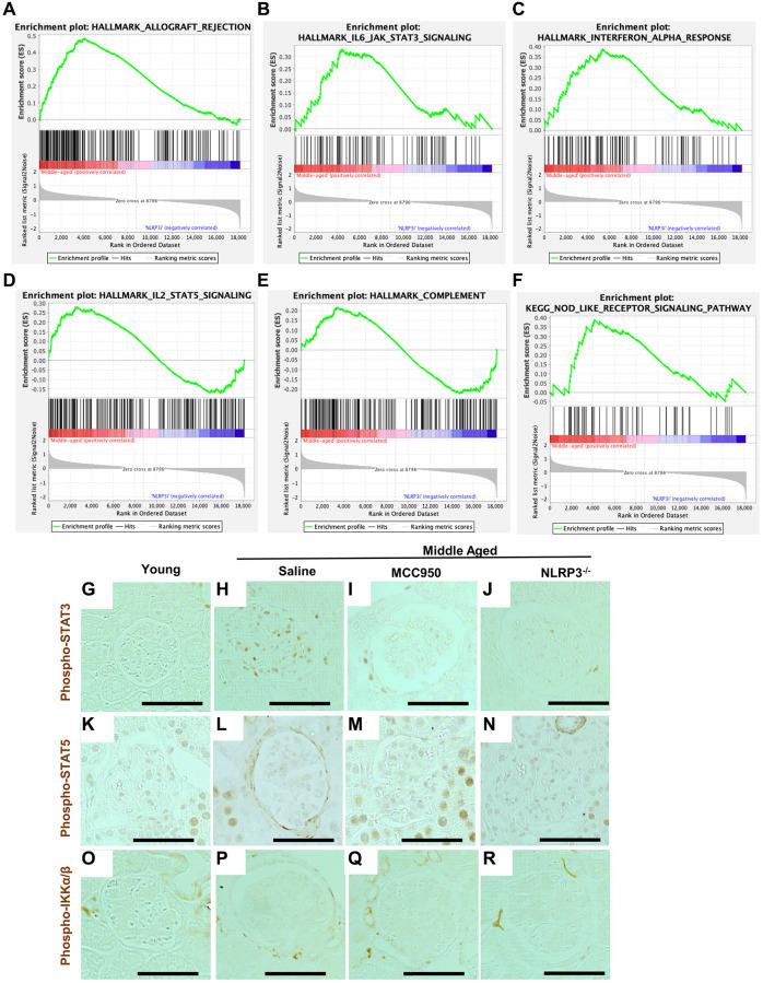 https://cdn.ncbi.nlm.nih.gov/pmc/blobs/456c/10415579/a840dc5152dc/aging-15-204897-g006.jpg