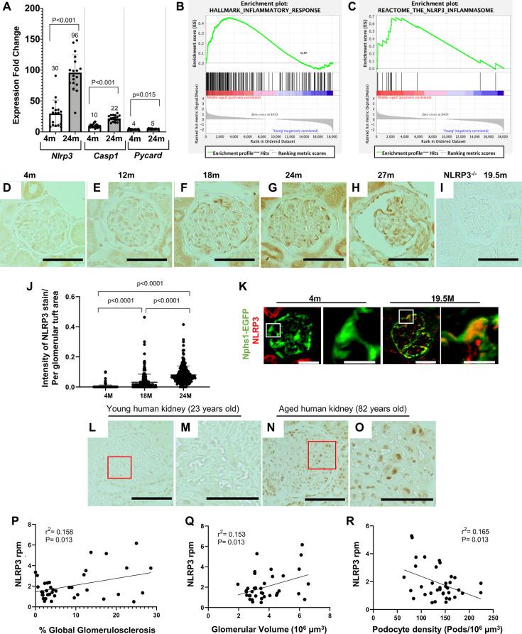 https://cdn.ncbi.nlm.nih.gov/pmc/blobs/456c/10415579/fcbd125a671f/aging-15-204897-g001.jpg