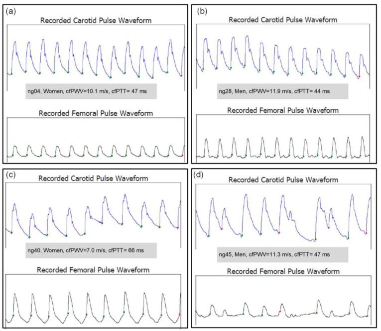 https://cdn.ncbi.nlm.nih.gov/pmc/blobs/456d/10347145/4faf7c3cb18c/sensors-23-05823-g003.jpg