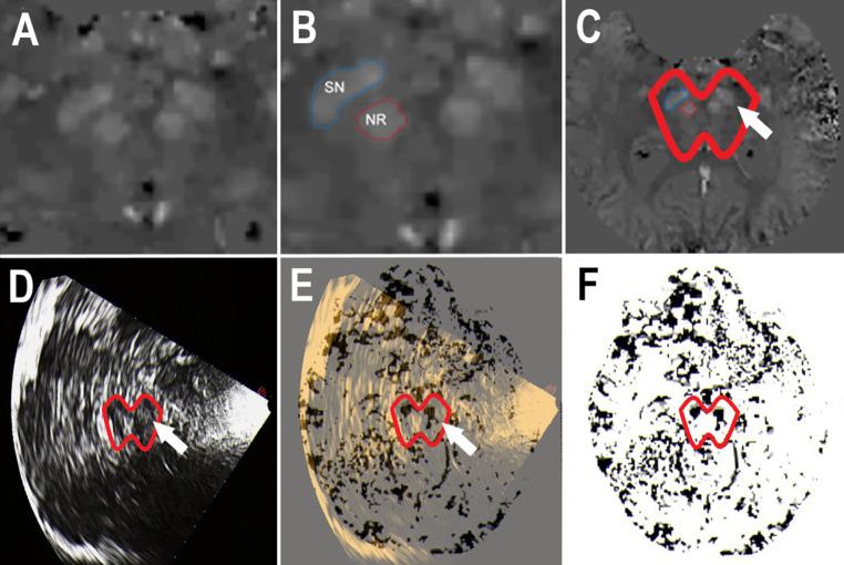 https://cdn.ncbi.nlm.nih.gov/pmc/blobs/456d/11870917/a18b8538cb06/702_2024_2856_Fig1_HTML.jpg