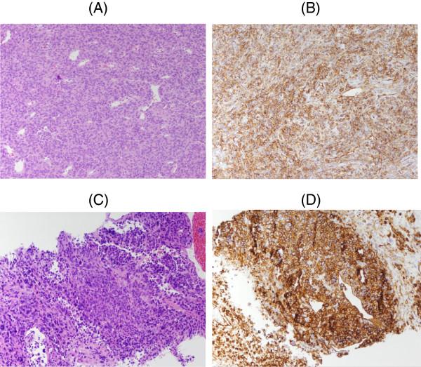 https://cdn.ncbi.nlm.nih.gov/pmc/blobs/4576/3546898/1483a3db5864/1752-1947-7-11-1.jpg