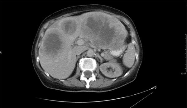 https://cdn.ncbi.nlm.nih.gov/pmc/blobs/4576/3546898/d601d5c90052/1752-1947-7-11-2.jpg