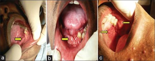 https://cdn.ncbi.nlm.nih.gov/pmc/blobs/4578/6974994/2b843a6759c8/CCD-10-154-g001.jpg