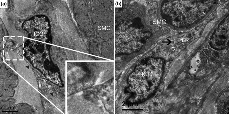 https://cdn.ncbi.nlm.nih.gov/pmc/blobs/457b/5898686/cabdca2e3997/10.1177_0963689717722561-fig2.jpg