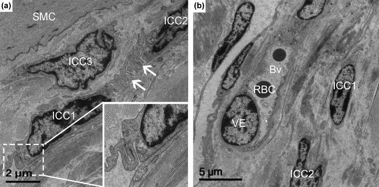 https://cdn.ncbi.nlm.nih.gov/pmc/blobs/457b/5898686/f61c10c178b6/10.1177_0963689717722561-fig7.jpg