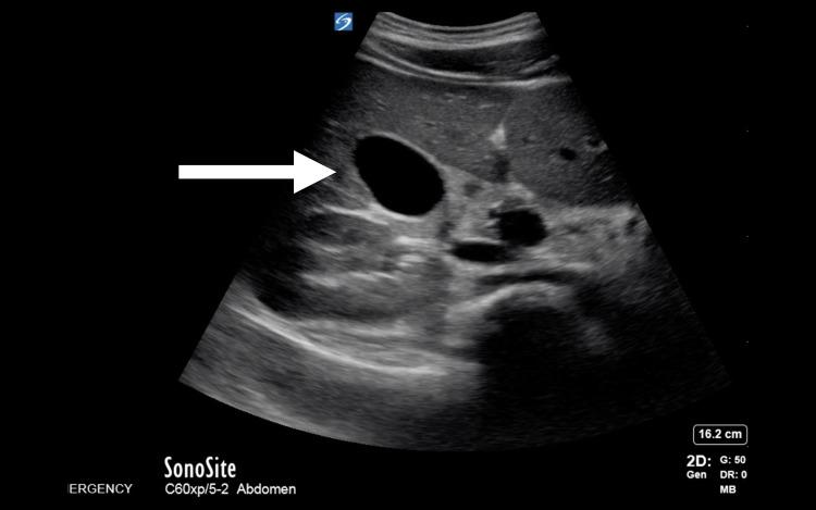 https://cdn.ncbi.nlm.nih.gov/pmc/blobs/4581/11366253/6b1b68840507/OAEM-16-221-g0003.jpg