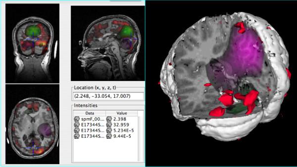 https://cdn.ncbi.nlm.nih.gov/pmc/blobs/4584/2099449/828e802cd37b/1471-2105-8-389-4.jpg