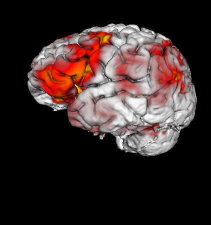 https://cdn.ncbi.nlm.nih.gov/pmc/blobs/4584/2099449/d9f0f11382fc/1471-2105-8-389-7.jpg