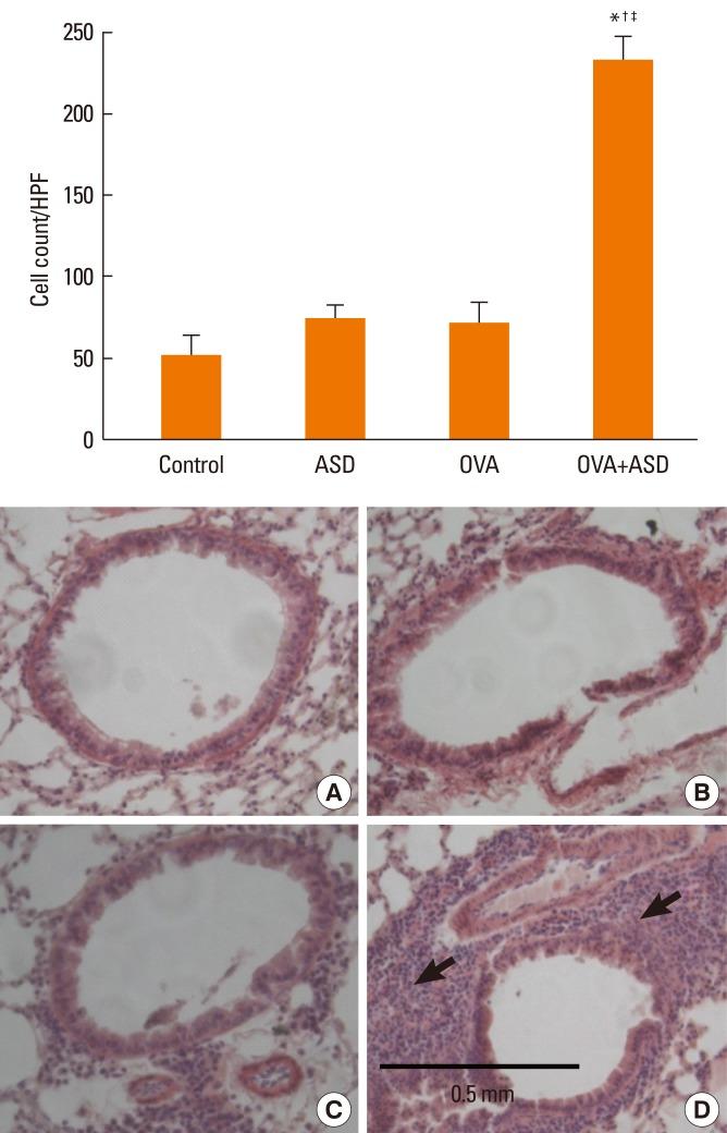 https://cdn.ncbi.nlm.nih.gov/pmc/blobs/4585/3378927/0fd19e0bb69a/aair-4-206-g003.jpg