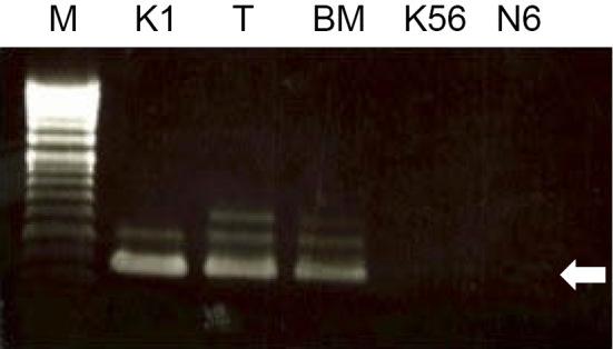 https://cdn.ncbi.nlm.nih.gov/pmc/blobs/458c/5849554/b32b52cebba3/1349-7235-57-0563-g003.jpg