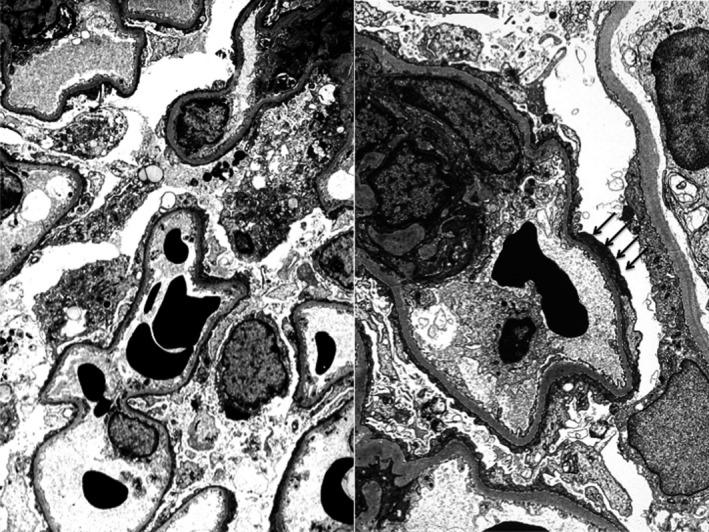 https://cdn.ncbi.nlm.nih.gov/pmc/blobs/458f/6220932/7670c3a0af28/AJT-18-2818-g001.jpg