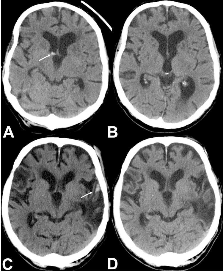 https://cdn.ncbi.nlm.nih.gov/pmc/blobs/4591/8629230/28b4275a5fe9/pone.0260560.g005.jpg