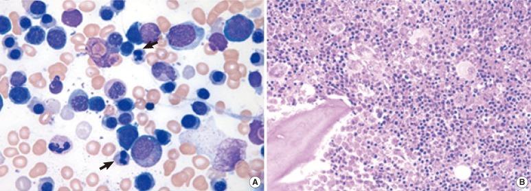 https://cdn.ncbi.nlm.nih.gov/pmc/blobs/4598/3589639/b4b360294671/alm-33-130-g001.jpg