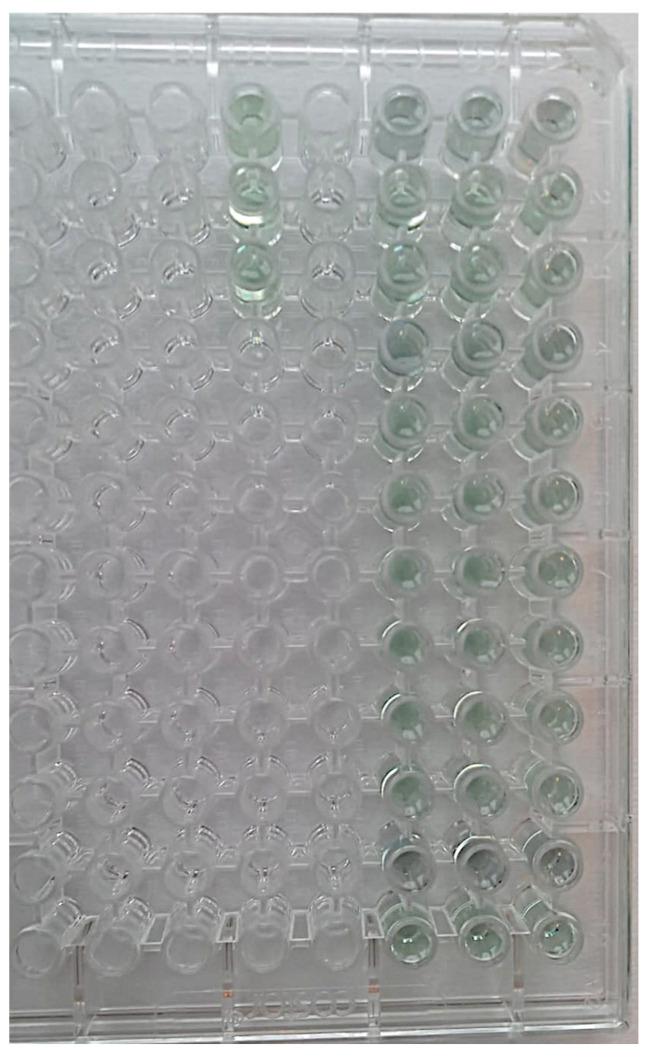 https://cdn.ncbi.nlm.nih.gov/pmc/blobs/459a/11048622/eb8a14f0cb8d/bioengineering-11-00387-g006.jpg