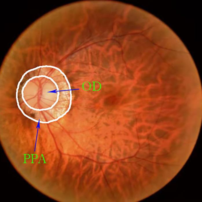 https://cdn.ncbi.nlm.nih.gov/pmc/blobs/459c/8550077/feba420837b8/fnins-15-758887-g002.jpg