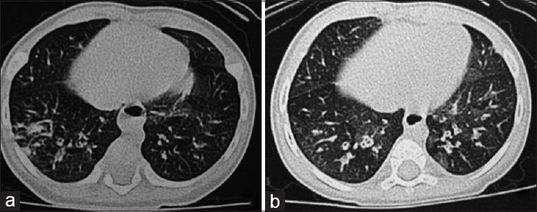 https://cdn.ncbi.nlm.nih.gov/pmc/blobs/45a1/5695073/f018caed8b01/CMJ-130-2771-g001.jpg
