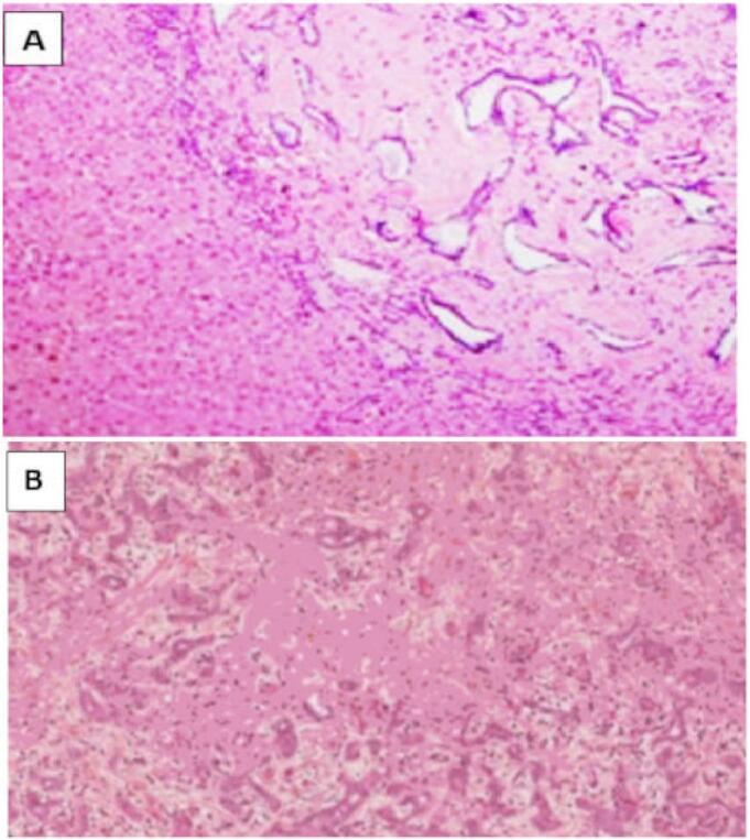 https://cdn.ncbi.nlm.nih.gov/pmc/blobs/45ad/12212256/313dd7c1e7d0/gr2.jpg
