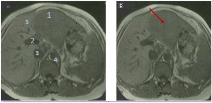 https://cdn.ncbi.nlm.nih.gov/pmc/blobs/45ad/12212256/a3267868abd3/gr1.jpg