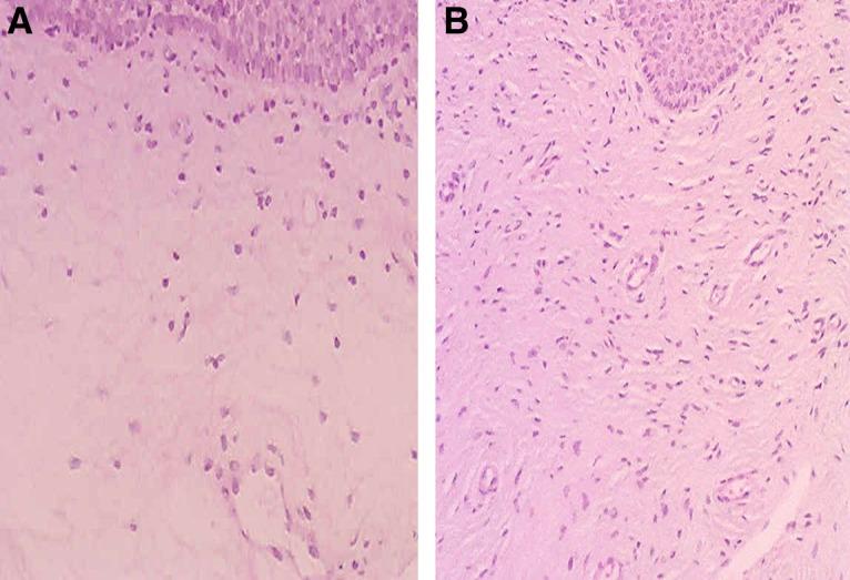 https://cdn.ncbi.nlm.nih.gov/pmc/blobs/45bd/6648197/541ab21351fa/fig-4.jpg