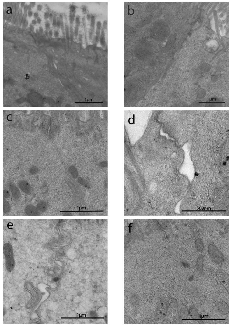 https://cdn.ncbi.nlm.nih.gov/pmc/blobs/45cb/8533783/d4d415a10b13/cells-10-02593-g003.jpg