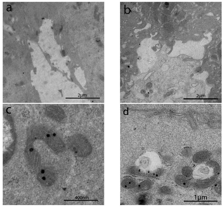 https://cdn.ncbi.nlm.nih.gov/pmc/blobs/45cb/8533783/da07fc2370e1/cells-10-02593-g005a.jpg