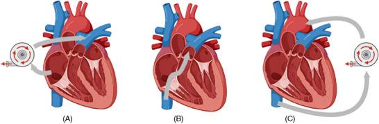 https://cdn.ncbi.nlm.nih.gov/pmc/blobs/45cd/11683856/3049f3c6e984/CTR-39-e70066-g001.jpg