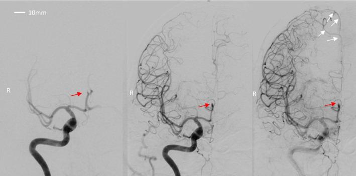 https://cdn.ncbi.nlm.nih.gov/pmc/blobs/45d7/11447169/0a4cf6214c5a/13550_2024_1154_Fig2_HTML.jpg