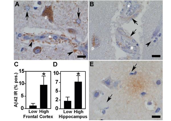 https://cdn.ncbi.nlm.nih.gov/pmc/blobs/45d8/1570474/df92d8803240/1743-8977-3-13-3.jpg