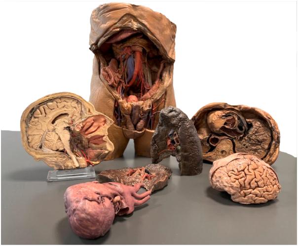 https://cdn.ncbi.nlm.nih.gov/pmc/blobs/45dc/11323862/5fd596b40cde/IFSO_A_2381956_F0005_C.jpg
