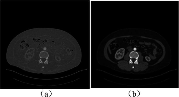 https://cdn.ncbi.nlm.nih.gov/pmc/blobs/45e0/11076390/2a60b48f05c9/11517_2024_3025_Fig2_HTML.jpg