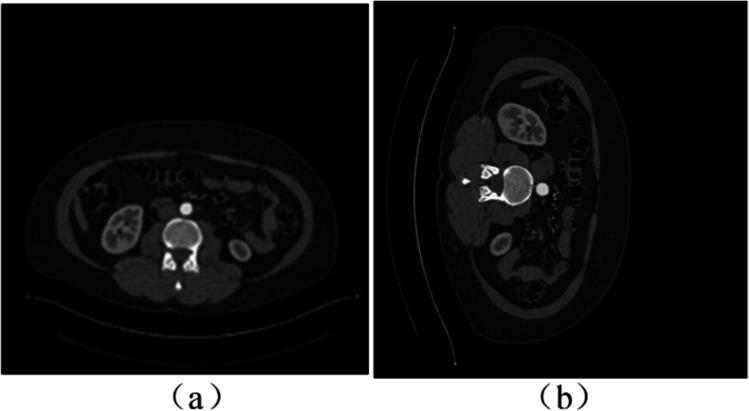 https://cdn.ncbi.nlm.nih.gov/pmc/blobs/45e0/11076390/c2e4303fd215/11517_2024_3025_Fig3_HTML.jpg