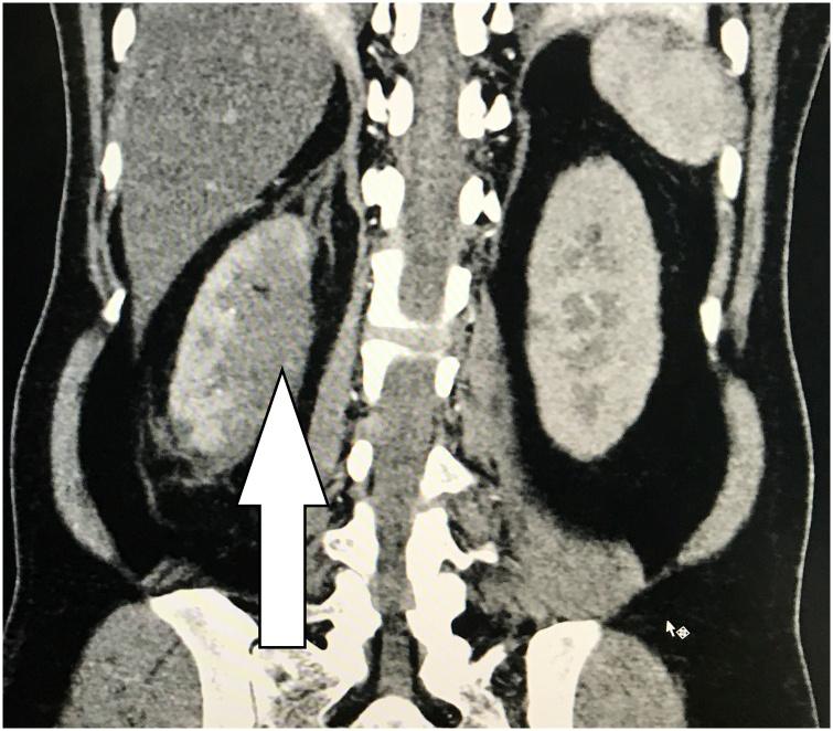 https://cdn.ncbi.nlm.nih.gov/pmc/blobs/45e2/7708759/c8a12f7e2843/gr2.jpg