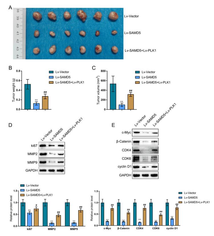 https://cdn.ncbi.nlm.nih.gov/pmc/blobs/45e8/11550111/aa0cddeb349d/cureus-0016-00000073259-i11.jpg