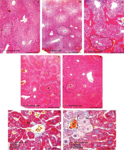 https://cdn.ncbi.nlm.nih.gov/pmc/blobs/45ea/3071176/34c9cda76a34/LJM-5-4891-g004.jpg