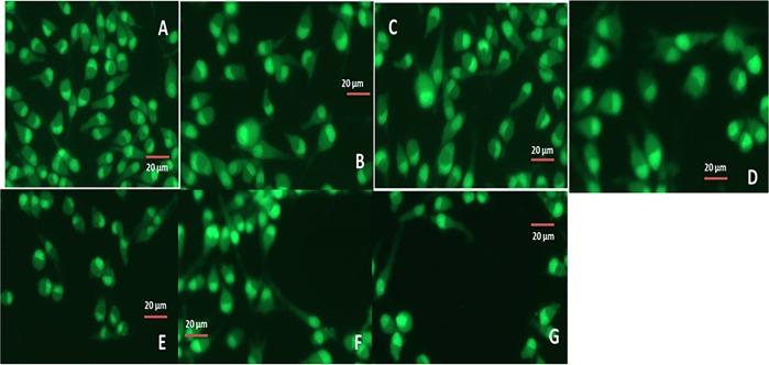 https://cdn.ncbi.nlm.nih.gov/pmc/blobs/45f4/6946659/81dc1b39c29b/41419_2019_2182_Fig9_HTML.jpg