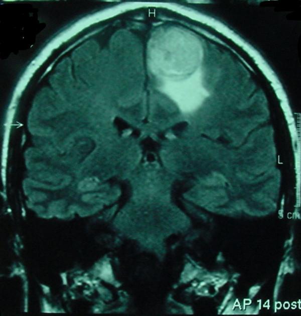 https://cdn.ncbi.nlm.nih.gov/pmc/blobs/45f9/524360/de44aae16dc9/1471-2407-4-74-1.jpg