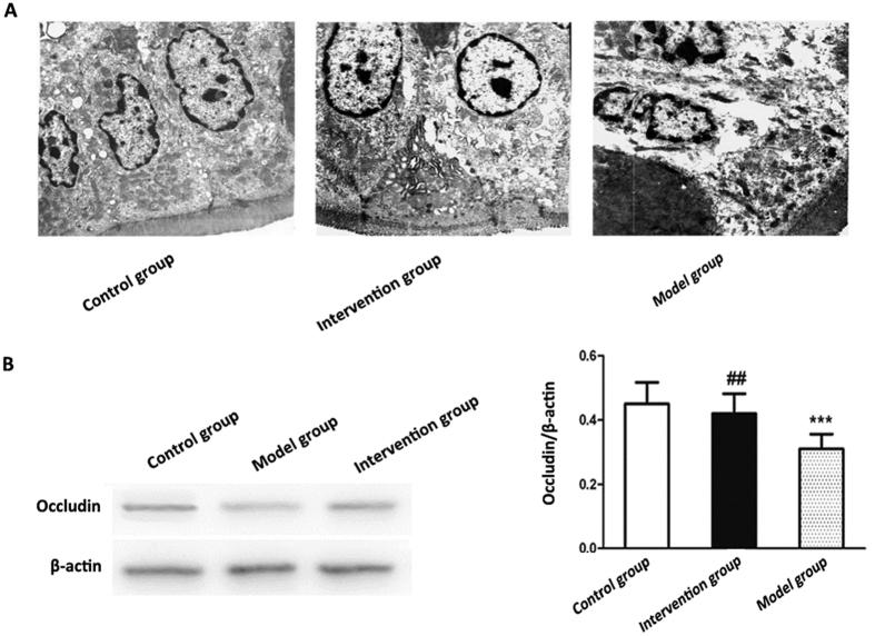 https://cdn.ncbi.nlm.nih.gov/pmc/blobs/45fe/5368635/e44ab6daacbf/srep45176-f6.jpg