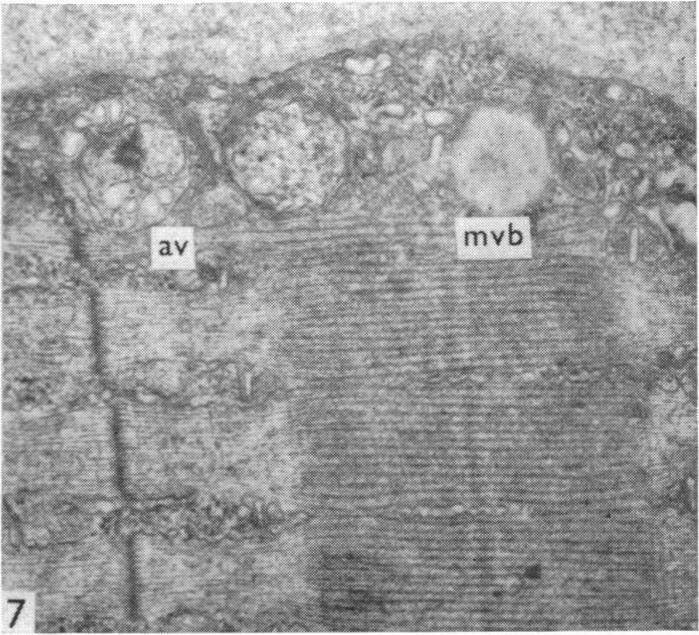 https://cdn.ncbi.nlm.nih.gov/pmc/blobs/4606/1331942/6a5c389f5cc5/jphysiol01020-0089-d.jpg