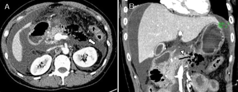 https://cdn.ncbi.nlm.nih.gov/pmc/blobs/4611/9512950/ada7f046cbdb/40792_2022_1542_Fig3_HTML.jpg