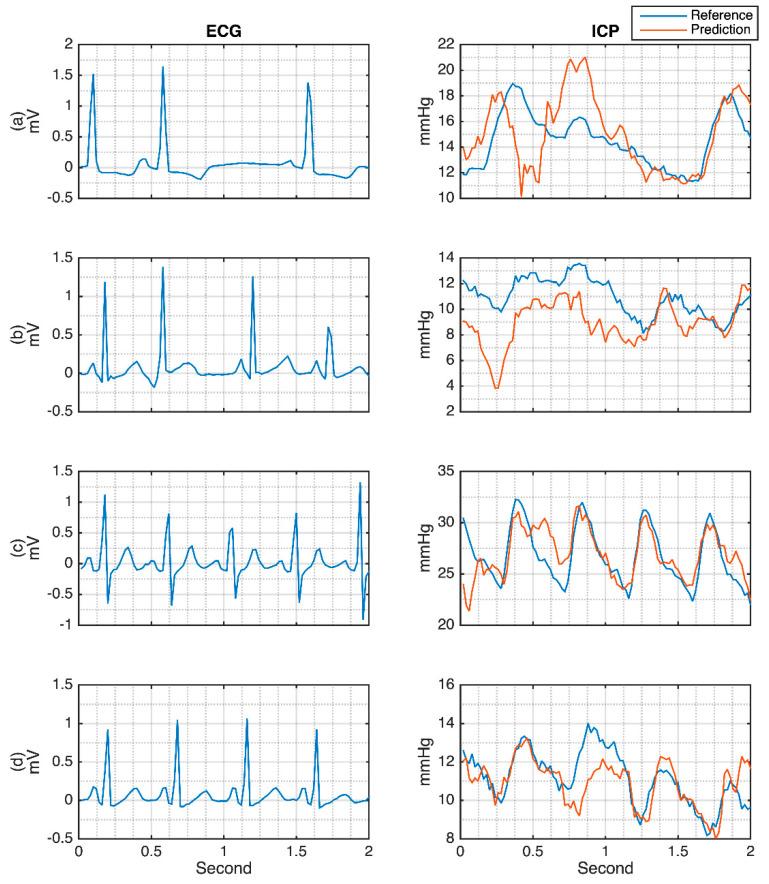 https://cdn.ncbi.nlm.nih.gov/pmc/blobs/4619/8469191/1774d5d87fc2/sensors-21-06264-g012.jpg