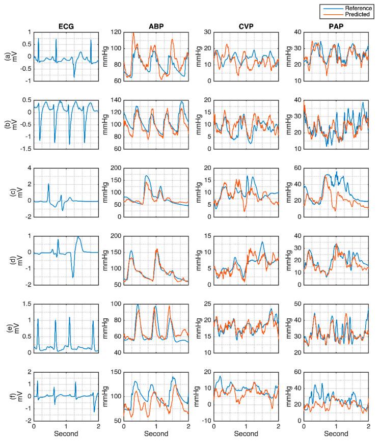 https://cdn.ncbi.nlm.nih.gov/pmc/blobs/4619/8469191/3b87e20c4389/sensors-21-06264-g011.jpg