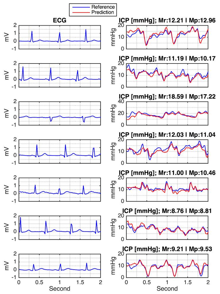 https://cdn.ncbi.nlm.nih.gov/pmc/blobs/4619/8469191/f4a17dffa1a5/sensors-21-06264-g008.jpg