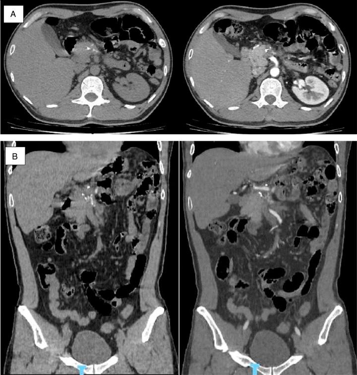 https://cdn.ncbi.nlm.nih.gov/pmc/blobs/461d/10783418/05f42abd522a/ms9-86-580-g006.jpg